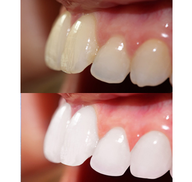 Teeth  retouching for doctor 